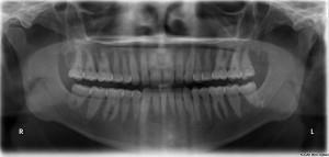 primus dental design digital x rays paperless dental office 300x143 - Where to Start with a Paperless Transition - A Plan