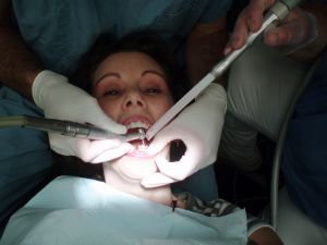 Primus Dental veneers - Put Your Dental Practice To Work: Increase Revenue In 4 Easy Ways